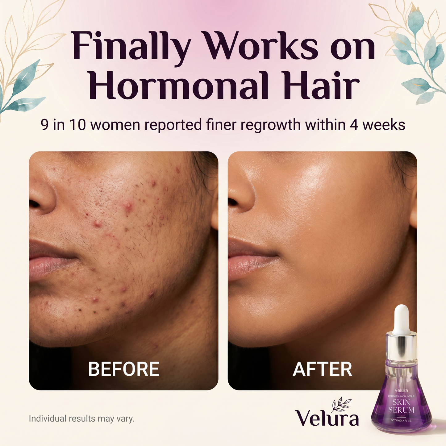 Velura Skin Ritual — Cyperus Rotundus Botanical Oil